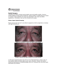 Eyelid Surgery Complete eye health includes having healthy eyes