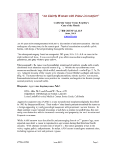 COTM0613 - California Tumor Tissue Registry