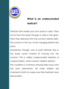 What is an undescended testicle?