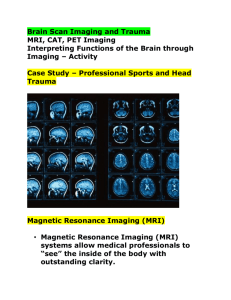 Brain Scan Imaging and Trauma (from ppt)