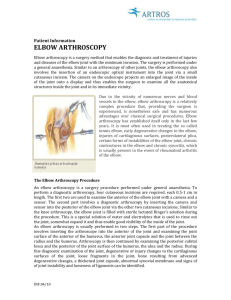 Elbow arthroscopy: Information for patients