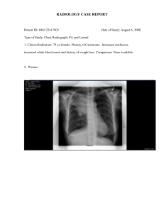 DI-Chest-Lung Ca