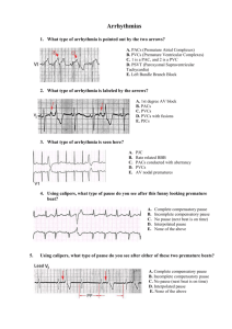 What type of arrhythmia is pointed out by the two arrows