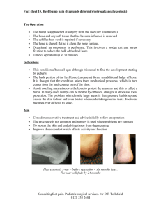 (heel bump) (15) - Consulting Foot Pain