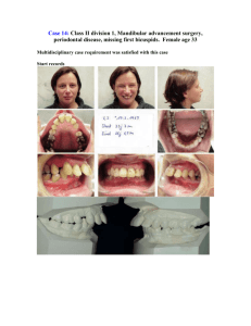 Case 14: Class II division 1, Mandibular advancement surgery