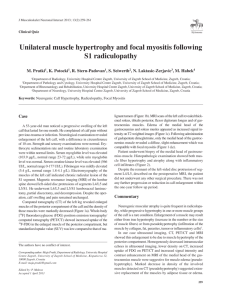 Unilateral muscle hypertrophy and focal myositis following S1