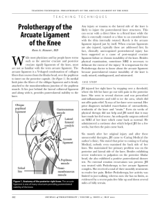 Prolotherapy of the Arcuate Ligament of the Knee