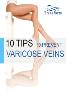 10 Tips to Prevent Varicose Veins