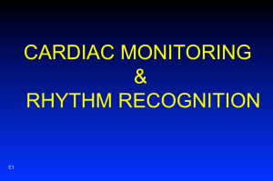 CARDIAC MONITORING & RHYTHM RECOGNITION