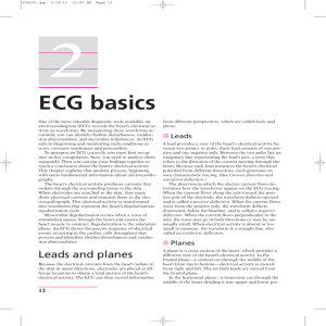 ECG basics