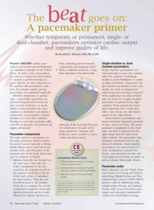 A pacemaker primer - American Nurse Today