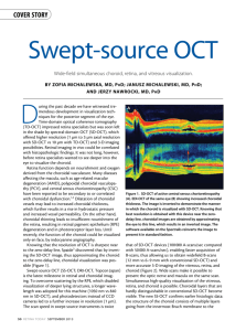 Swept-source oCt