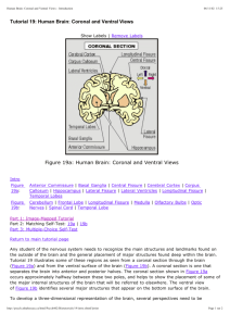Tutorial 19: Human Brain: Coronal and Ventral Views Figure 19a