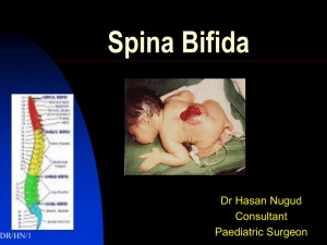 Spina Bifida - Dr Hasan Nugud