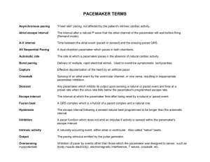 pacemaker terms