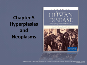Chapter 5 Hyperplasias and neoplasms