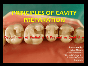 CavityPrepPresentation1