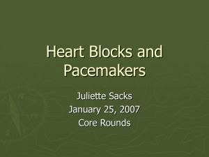 Heart Blocks and Pacemakers - Calgary Emergency Medicine
