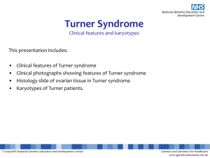 Turner syndrome (explanation slides)