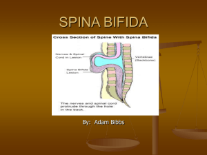 Spina Bifida Power Point Presentation