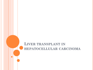 Liver transplant in hepatocellular carcinoma