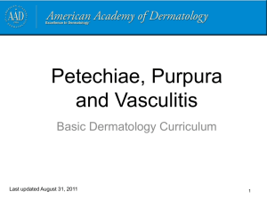 Petechiae and Purpura - American Academy of Dermatology