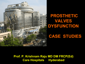 prosthetic valves dysfunction