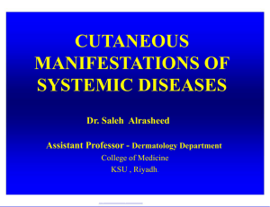 4-cut-manifestations-vasculitis2015-12