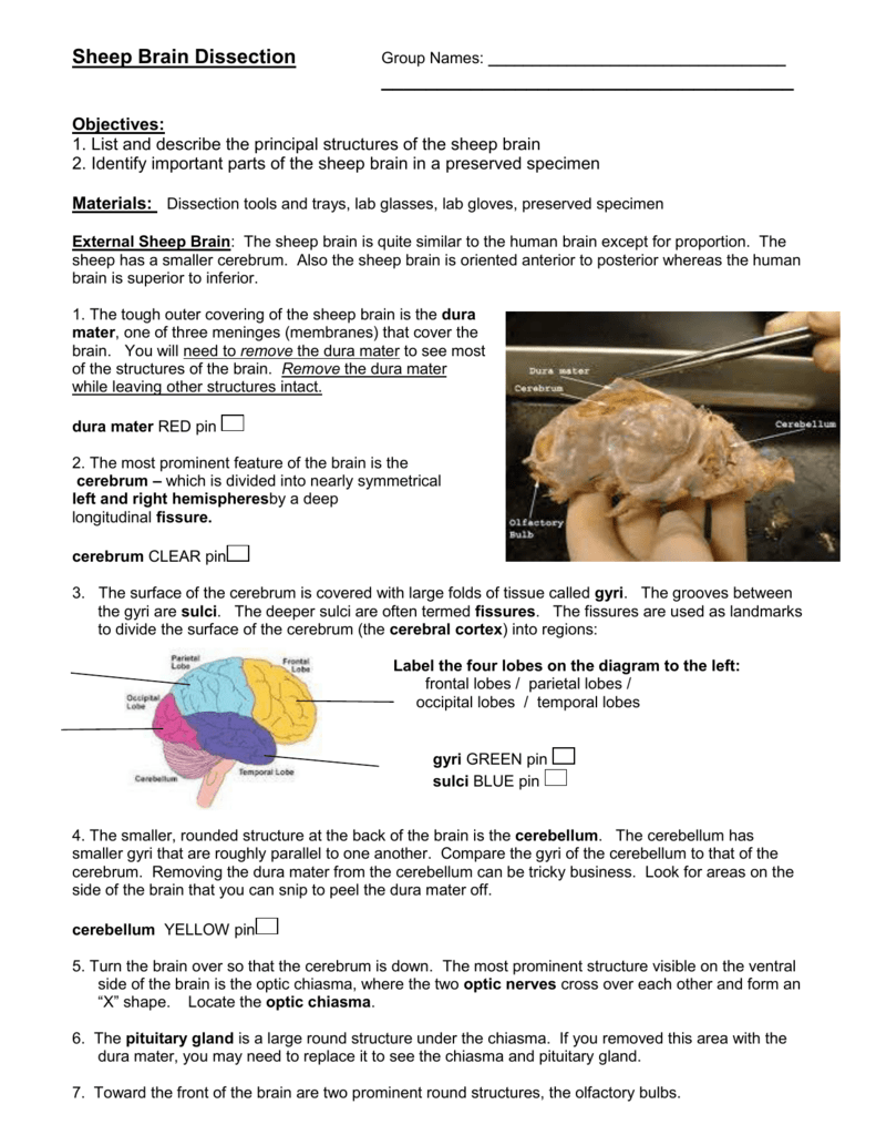 Sheep Brain Diagram Lobes Smartdraw Diagrams