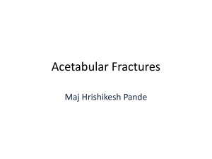 Acetabular Fractures