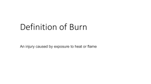 Definition of Burn