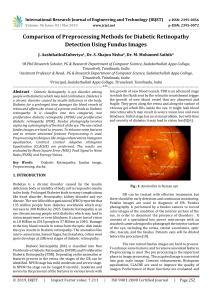 IRJET-    Comparison of Preprocessing Methods for Diabetic Retinopathy Detection using Fundus Images
