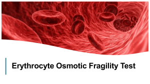 Erythrocyte osmotic fragility test