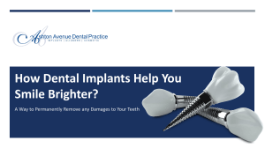 Want to Smile Brighter? Discover How Dental Implants Help You