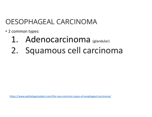 Oesophageal Carcinoma