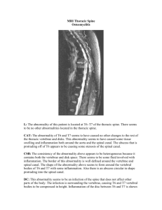 MRI Thoracic Spine Osteomyelitis L: The abnormality of this patient