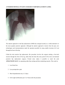 Anterior hip replacement