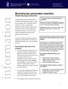 Biventricular pacemaker: Patient discharge instructions (MC1640)