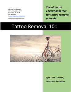 Laser Tattoo Removal 101