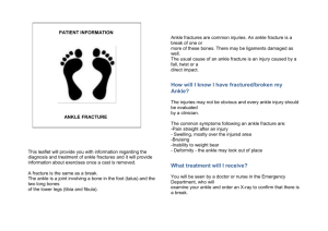 DOWNLOAD: Ankle Fracture Patient Information leaflet