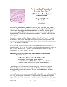 COTM0315 - California Tumor Tissue Registry