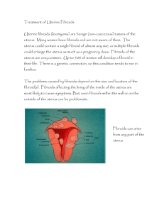 Treatment-of-Uterine-Fibroids
