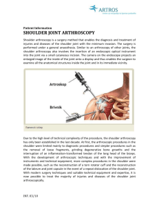 Shoulder arthroscopy: Information for patients