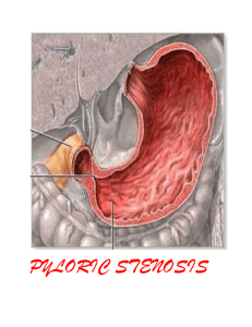 PYLORIC STENOSIS - Wiki-Pediatric