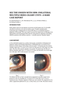 see the unseen with ubm: unilateral multiple irido-ciliary cysts