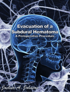 Evacuation of a Subdural Hematoma