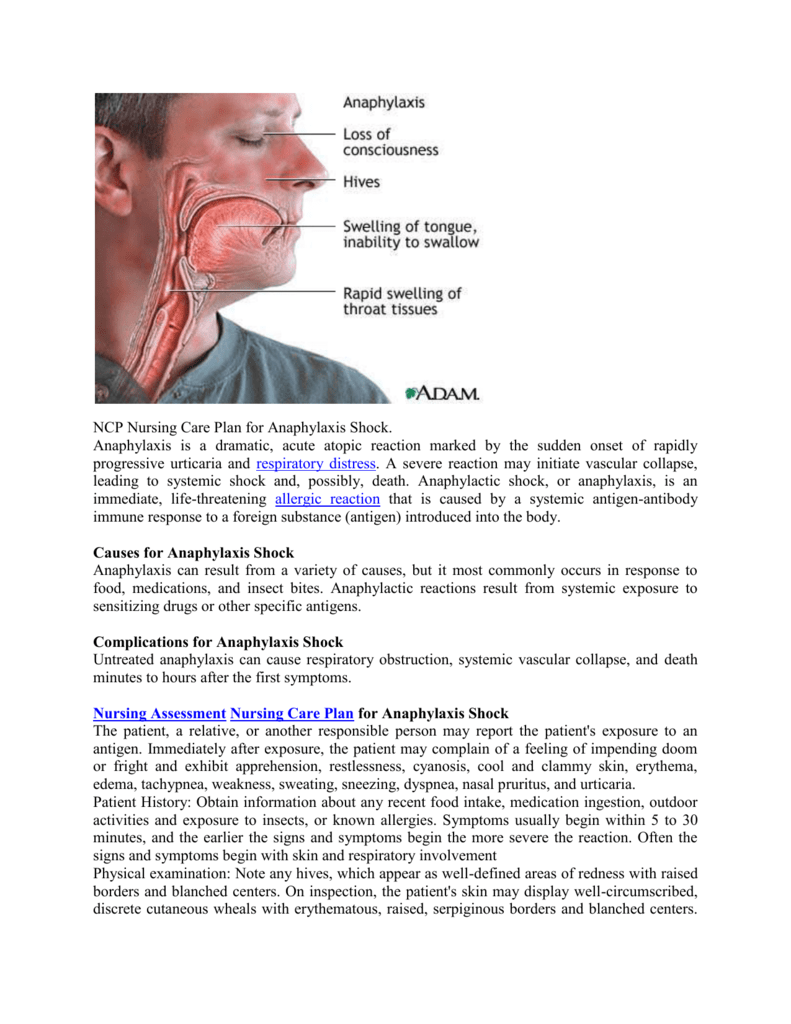 Shock Nursing Care Plan