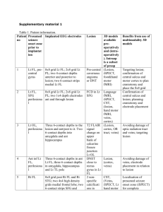 supplementary	grid