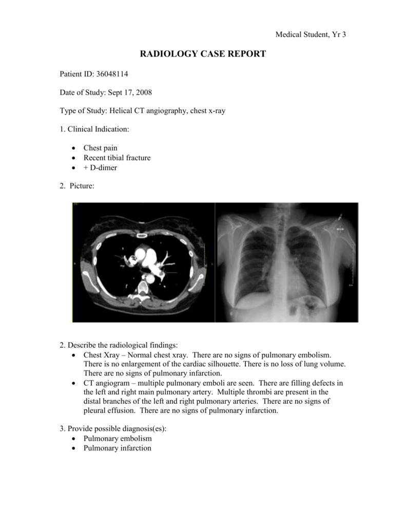 Radiology Report Writing at Janeth Blankenship blog