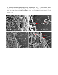 Fig. S1 Scanning electron micrographs images showing the